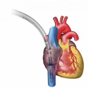 картинка Венозные канюли imkokangxin®